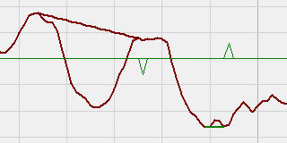 Divergenz-MACD